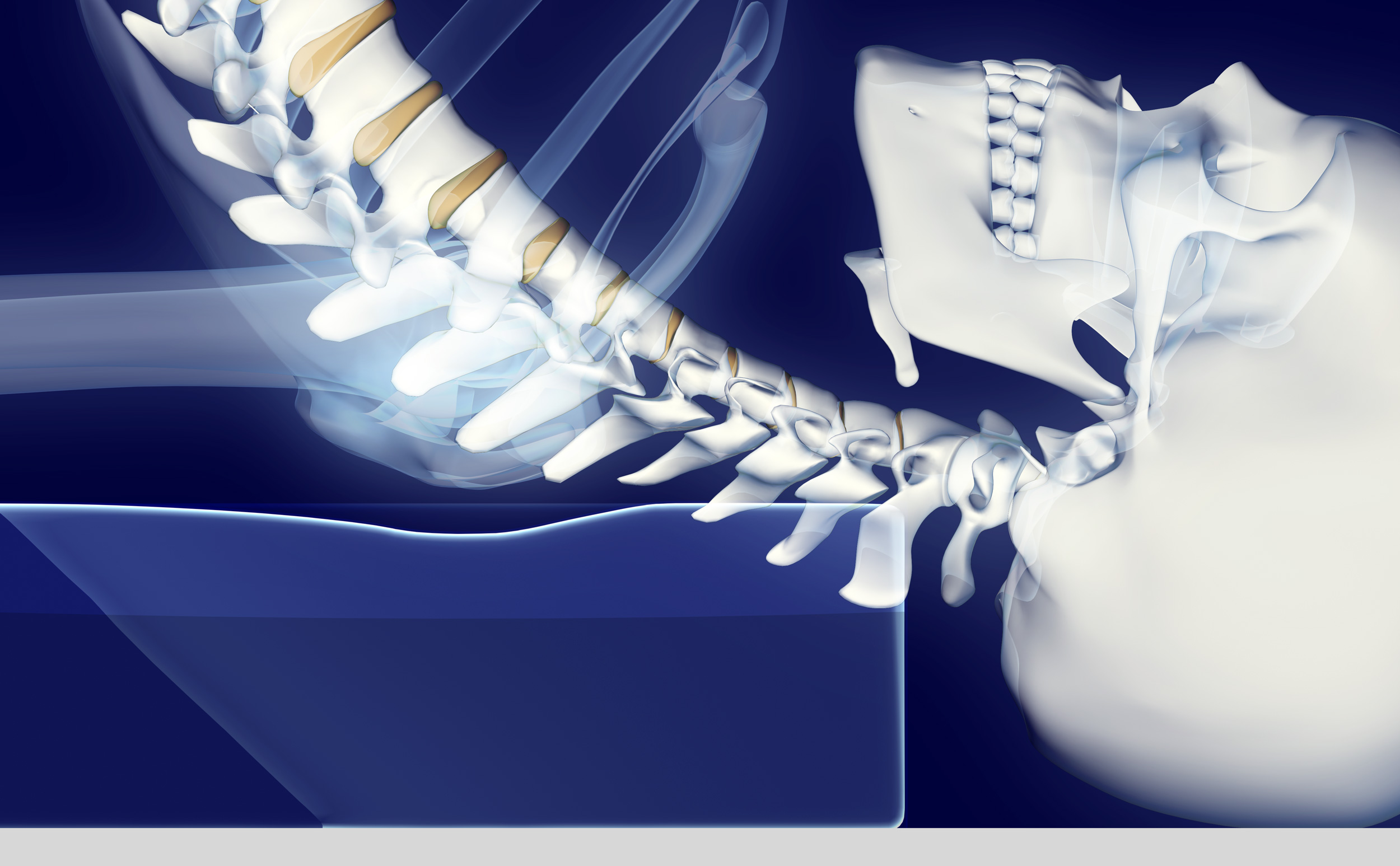 The cervical spine in shoulder stand using a Shoulder Stander